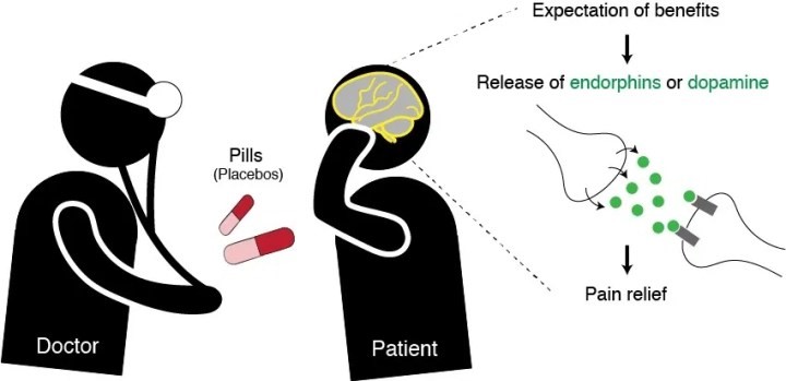 A doctor giving a patient placebo pills. The patient's expectation of benefits causes a release of endorphins or dopamine leading to pain relief.